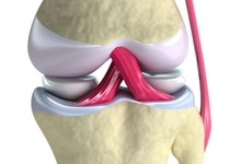 Arka Menisküs Yırtığı Belirtileri ve Tedavisi