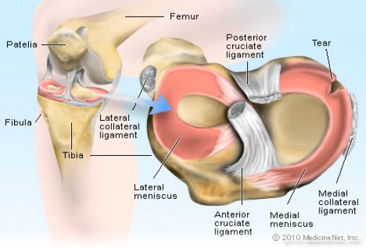 Lateral Menisks